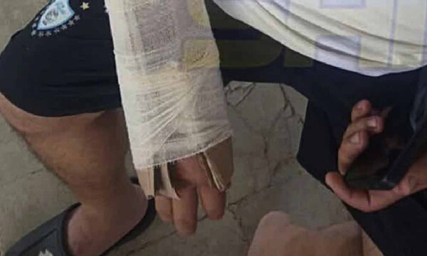 IPS San Antonio: Tuvo una fractura y le pusieron cartón en vez de yeso – Prensa 5