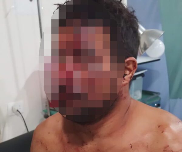 Hombre es macheteado por sus cuñados tras una discusión en Naranjal