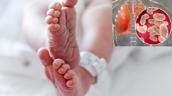 Alerta epidemiológica por aumento de casos de tos ferina y muerte de bebé