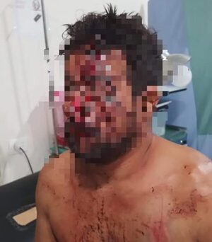 Hombre es herido a machetazos por sus cuñados tras una discusión en Naranjal – Diario TNPRESS