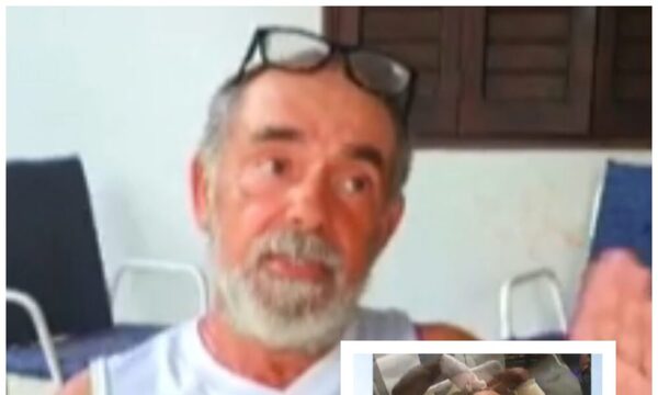Víctima de ataque de tres pitbulls: “Le mordí al perro con todas mi fuerzas”