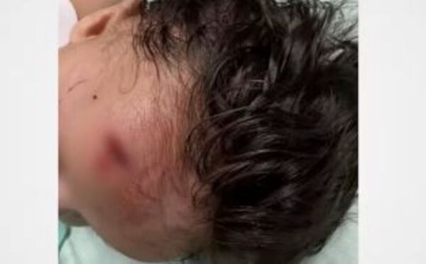 ¡Terrible!: Bebé de 3 meses herida en Clínicas tras caída de techo del ascensor