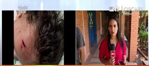 Bebé herido tras desprendimiento del techo de un ascensor en el Hospital de Clínicas - SNT