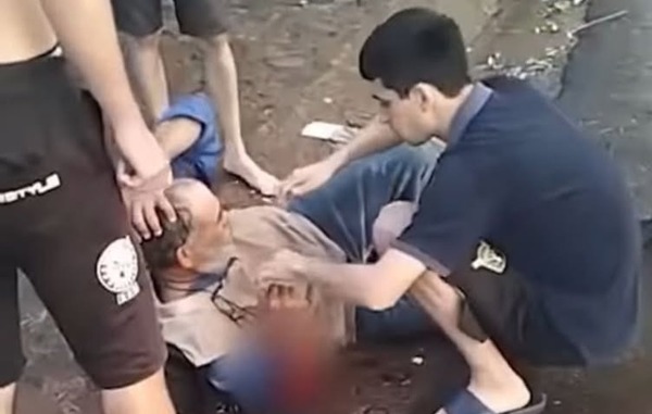Hombre de 65 años fue atacado por dos perros pitbulls en la vía pública