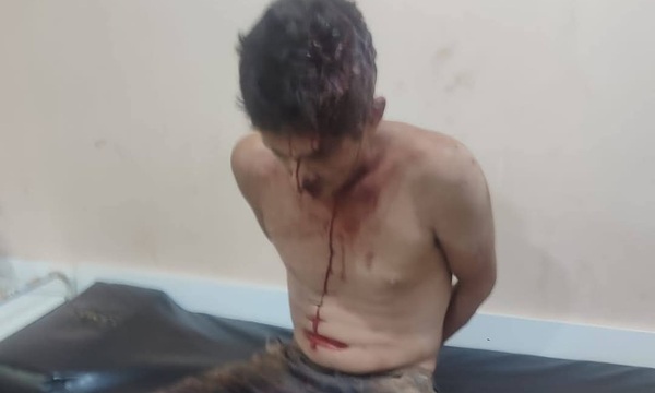 Ataque con machete en plena misa deja varios heridos en San Juan Nepomuceno - OviedoPress