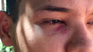 Joven brutalmente agredido en un local gastronómico de Concepción exige justicia