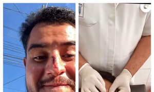 Influencer mexicano fue reventado y asaltado en CDE