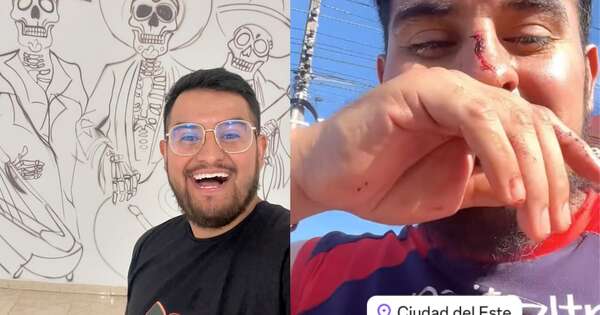 La Nación / Viral: influencer mexicano fue víctima de brutal agresión en CDE