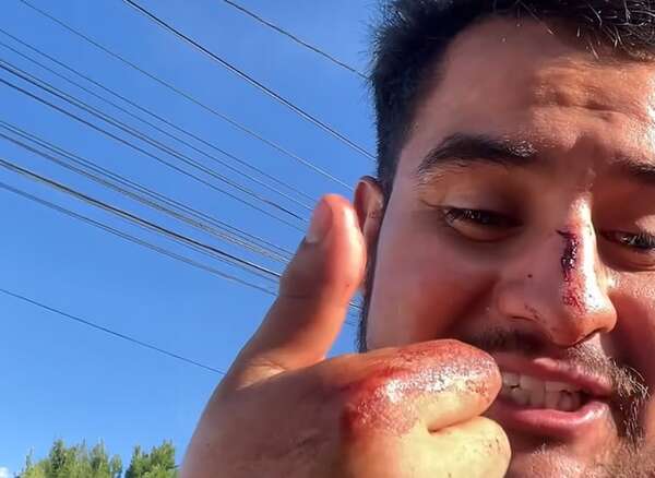 Video: youtuber mexicano denuncia que le robaron y “rompieron la cara” en CDE - Policiales - ABC Color