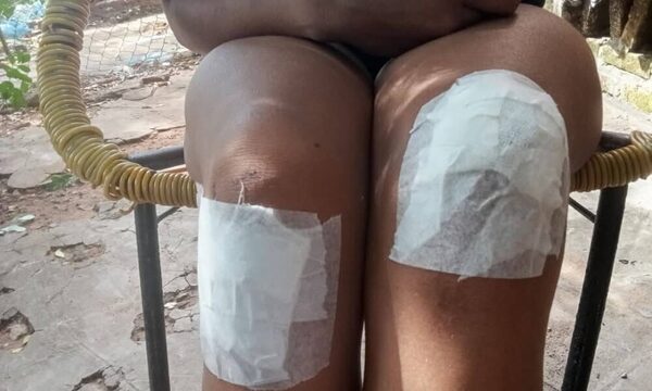 Joven agredida por su pareja teme por su vida