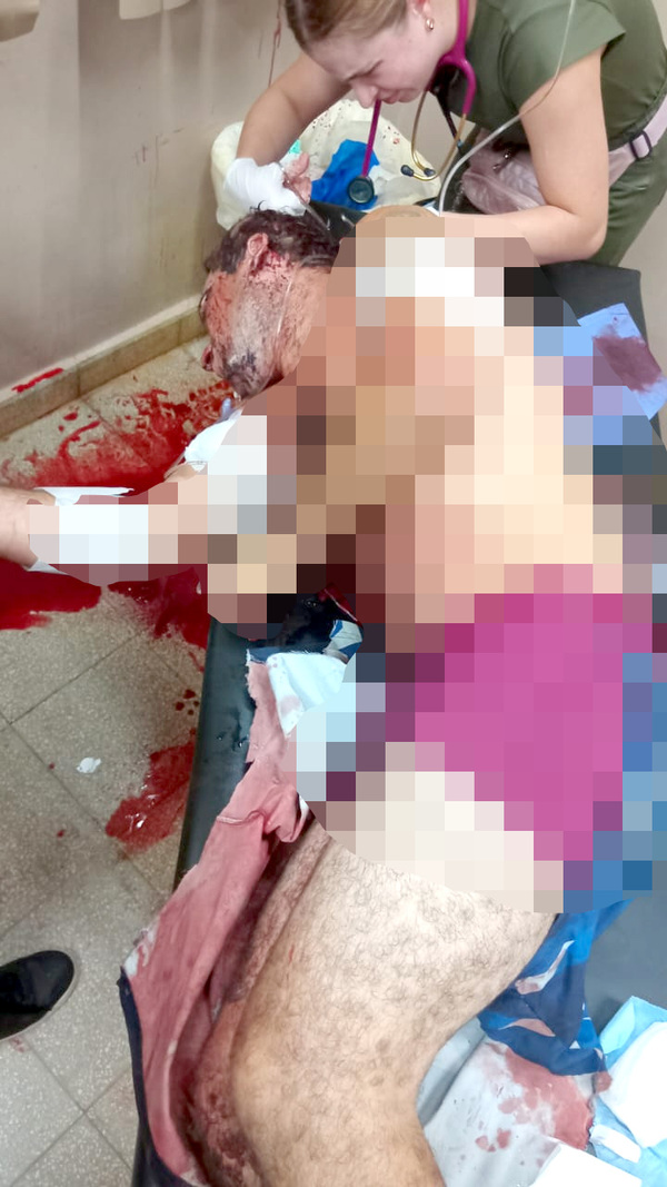 Exconvicto es macheteado durante pelea en el barrio Remansito de Ciudad del Este - La Clave