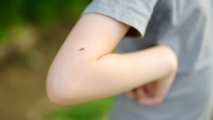 Dengue grave en niños pequeños: “puede ser mortal si no se trata rápidamente”, según especialista