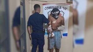 Ladrón intento escapar de la policía y se cortó vaipaite con vidrio