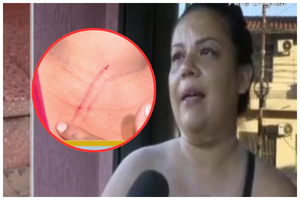 Mujer denuncia agresión de su hermano, pero él da otra versión - SNT