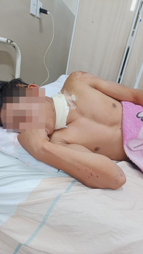 Motociclista casi muere degollado por un alambre colocado en medio de la calle - trece