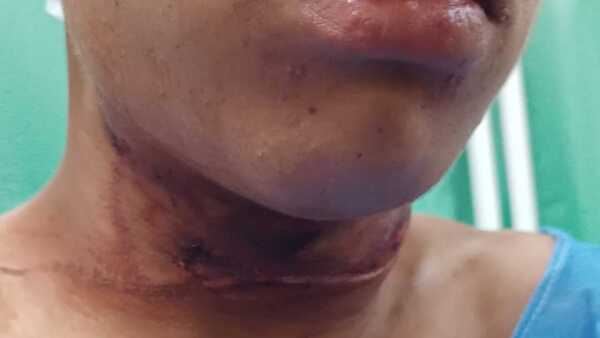 Hizo trampa anti motoca y casi degolló a un jovencito