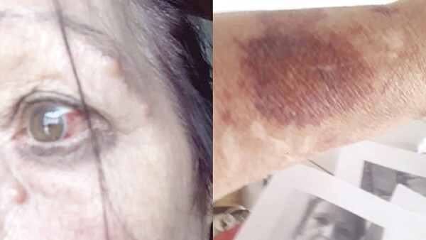 Doña vive un infierno y acusó a su hermano de tirar ácido por su casa