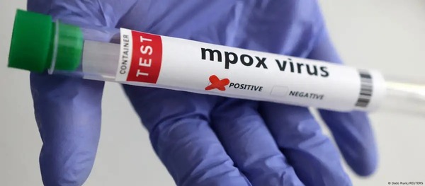 OMS mantiene emergencia internacional por mpox - ADN Digital