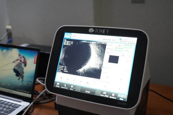 Recepcionan ecógrafo ocular en el Hospital Central del IPS - 1000 Noticias