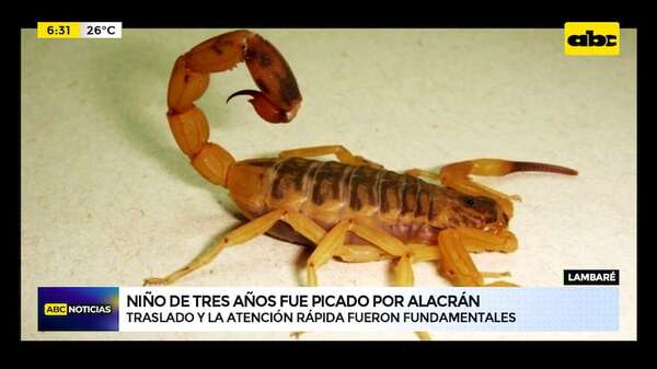 Video: Niño de tres años fue picado por alacrán amarillo en Lambaré - ABC Noticias - ABC Color