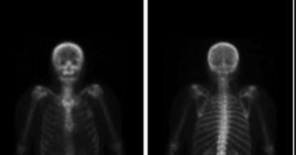 La Nación / Buscan mejorar el diagnóstico del cáncer de mama