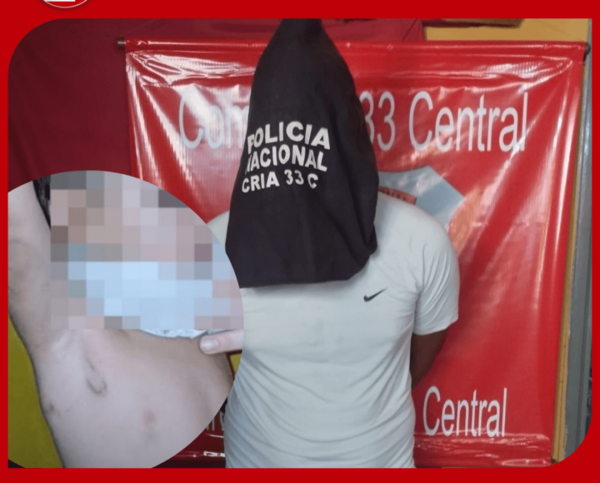 Joven de 22 años detenido por presunta agresión a un niño de 3 años