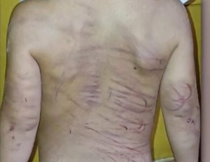 Detenido por agredir a su pareja y su hijastro de 3 años con cable y machete - ADN Digital