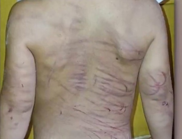 Detenido por agredir a su pareja y su hijastro de 3 años con cable y machete - ADN Digital
