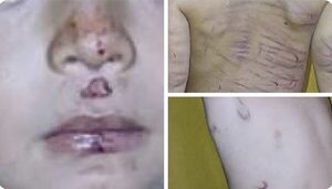 Niño de 3 años fue brutalmente golpeado por su padrastro con un cinto y un cable