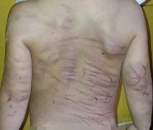 Capturan a joven que habría golpeado con un cable a su pareja e hijastro - Unicanal