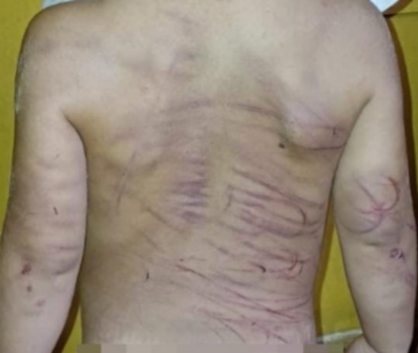 Capturan a joven que habría golpeado con un cable a su pareja e hijastro - Unicanal