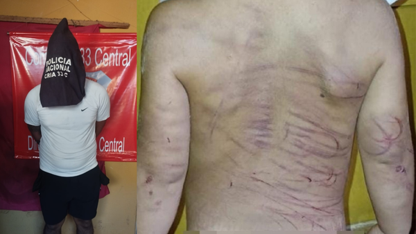 Hombre es detenido por agredir a golpes a su pareja y con cable y cinto a hijastro de 3 años