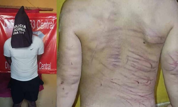 Hombre es detenido por agredir a goles a su pareja y con cable y cinto a hijastro de 3 años – Prensa 5