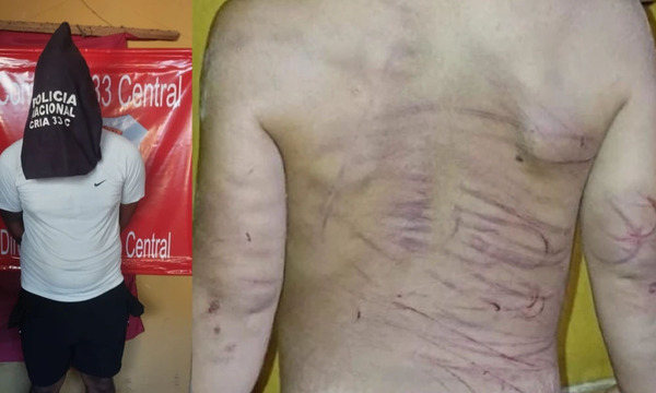 Hombre detenido por brutal agresión a su pareja e hijastro de 3 años - OviedoPress