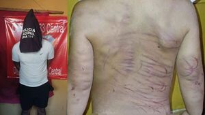 DETIENEN A UN HOMBRE POR AGREDIR A SU PAREJA Y A SU HIJASTRO DE 3 AÑOS