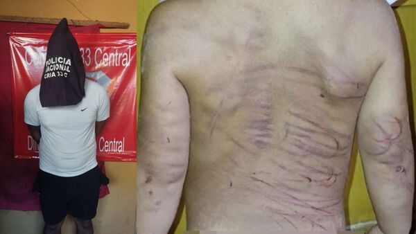 DETIENEN A UN HOMBRE POR AGREDIR A SU PAREJA Y A SU HIJASTRO DE 3 AÑOS
