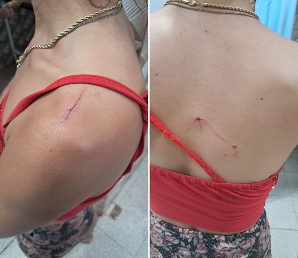 Hernandarias: detienen a joven por apuñalar a su pareja y a su madre - ADN Digital