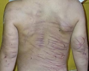 (VIDEO) Tilingo que torturó con cable a niño de 3 años justificó su violencia: “Hacía sus necesidades en la pieza”