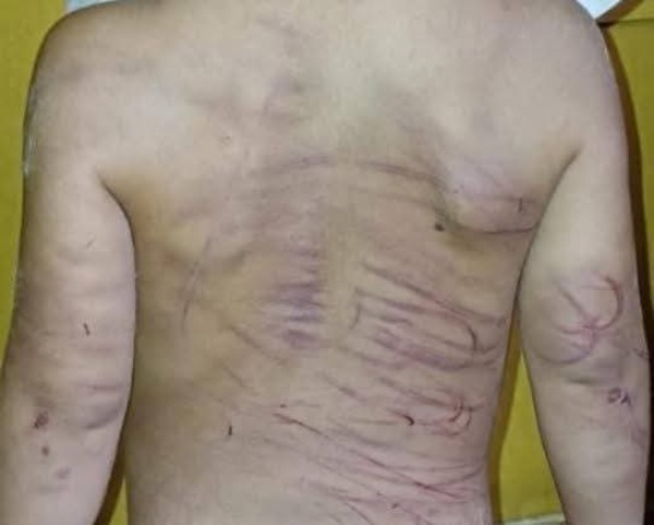 (VIDEO) Tilingo que torturó con cable a niño de 3 años justificó su violencia: “Hacía sus necesidades en la pieza”