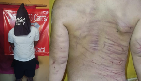 Un hombre es detenido por agredir a su pareja a golpes y a su hijastro de 3 años con un cable y un cinto
