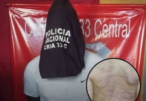 Imputan a presunto autor de agresión a niño y a su madre