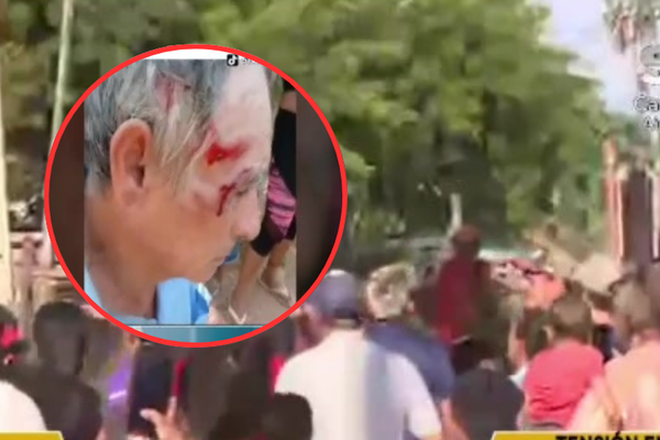 Hombre fue agredido por su hijo en Tablada - SNT