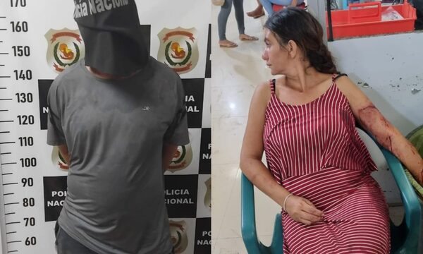 Imputan a sujeto que atacó con botella rota a su pareja