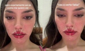 (VIDEO) ¿Qué piko le pasó? ¡Panelista de tevé apareció así en sus redes!