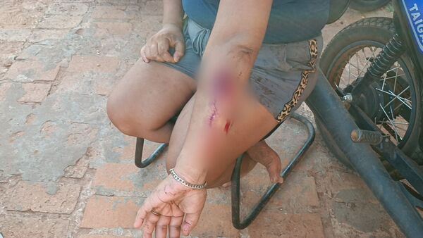 Riña entre supuestos adictos deja heridos en Calaverita