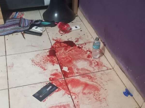 Violento robo: dispararon a trabajadora de una bodega en Tomás Romero Pereira - Policiales - ABC Color