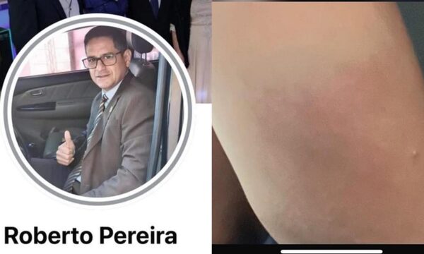 Denuncian agresión a enfermera en el Hospital Distrital de Presidente Franco