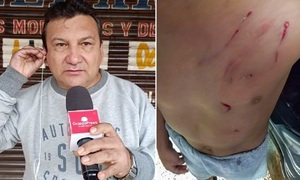 Otra más de Gerardo Melgarejo, amenazó de muerte a su vecino tras ataque de su perro a un niño de 5 años - OviedoPress