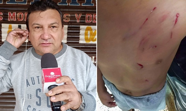 Otra más de Gerardo Melgarejo, amenazó de muerte a su vecino tras ataque de su perro a un niño de 5 años - OviedoPress