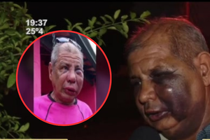 Brutal agresión a un adulto mayor en Villa Elisa - SNT